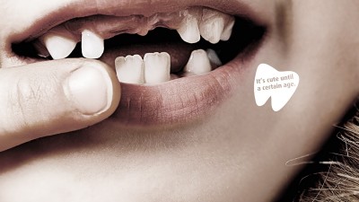 Smile Dental Clinic - It's only cute when you're young / v2