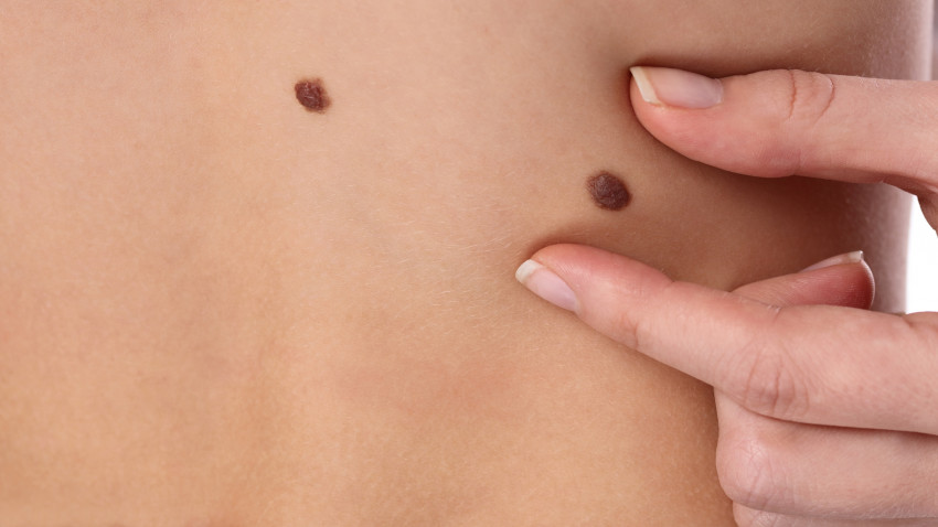 L’Oréal România, prin brandul La Roche-Posay, lansează o platformă digitală de educare privind riscurile expunerii la soare și importanța folosirii produselor de protecție solară