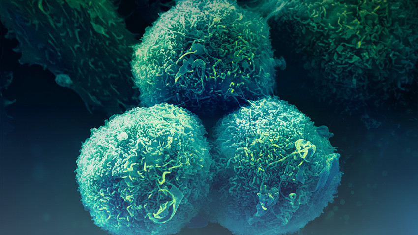 35% dintre respondenții la un test online prezintă factori ce pot indica riscul de a dezvolta cancer pulmonar