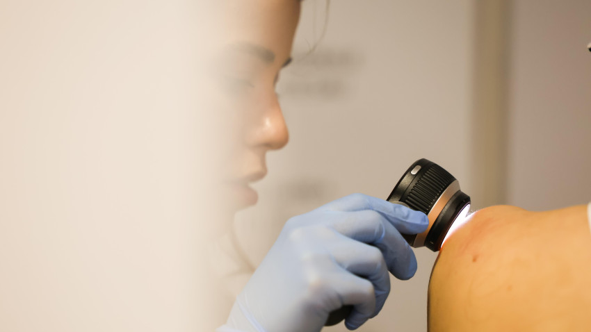 L’Oréal România continuă demersurile de prevenție a cancerului de piele și oferă acces la consultații dermatologice gratuite prin campania „Zilele Protecției Solare”